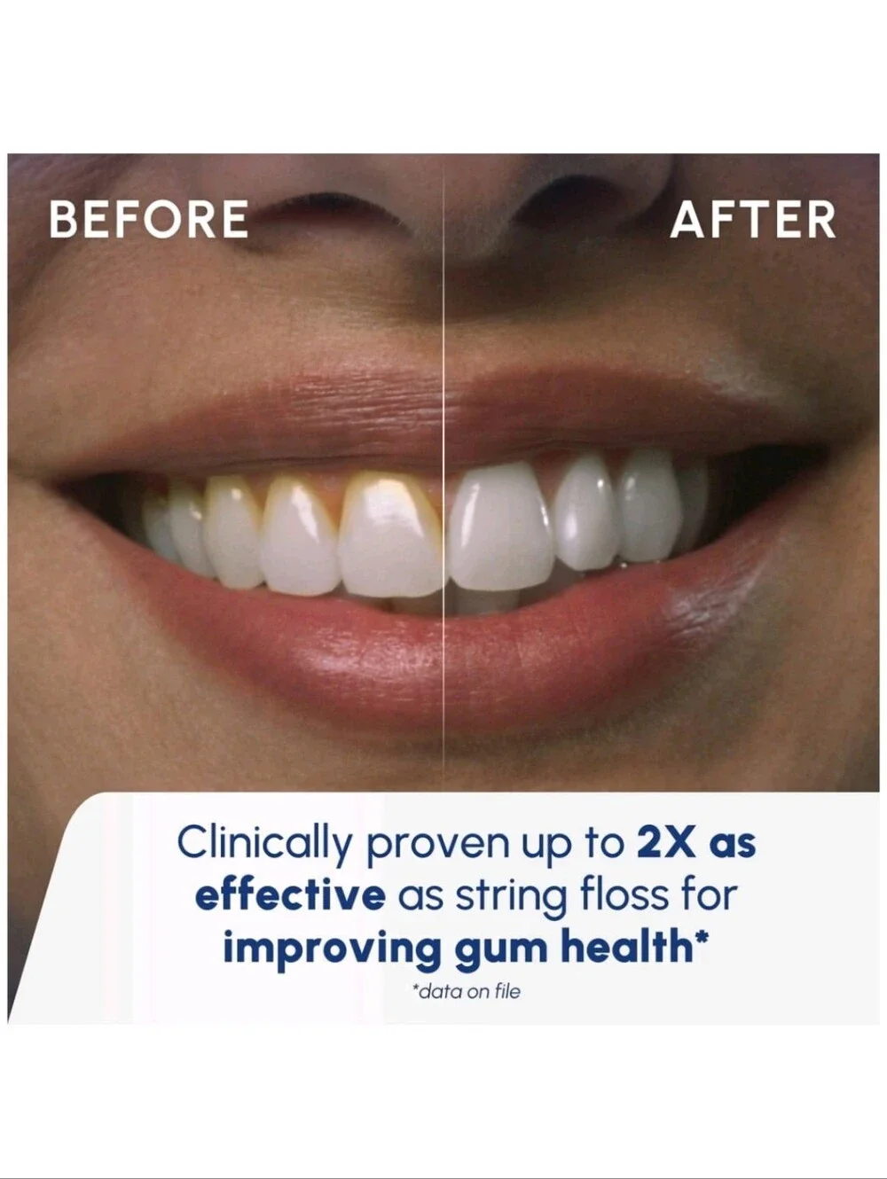 Waterpik Cordless Water Flosser